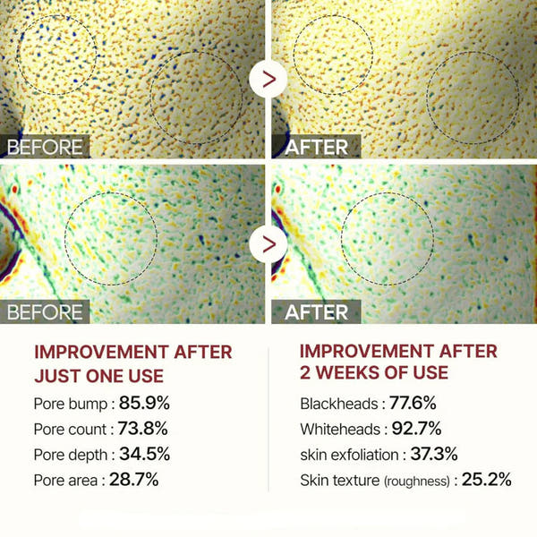 Radiant Glow Rice Peeling Ampoule™