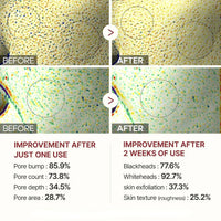 Radiant Glow Rice Peeling Ampoule™