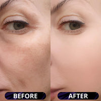 Radiant Glow Rice Peeling Ampoule™